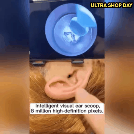 Limpiador Oídos Con Cámara HD